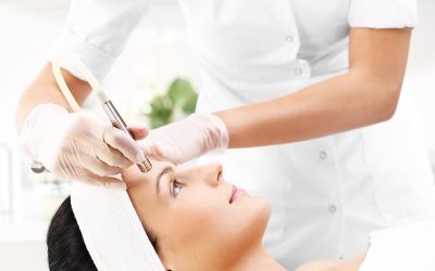 Microneedling in Macon, GA, Has Helped Many People with Skin Issues