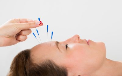 Achieve Inner Peace With Acupuncture For Stress In Berkeley, CA