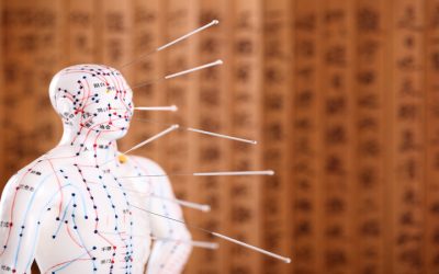 The Ins And Outs Of Acupuncture In Scottsdale AZ