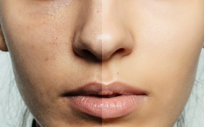 Reveal Your Best Skin Yet: Aging Skin Care in Upper Falls, MD